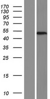 Western blot validation of overexpression lysate (Cat# LY411343) using anti-DDK antibody (Cat# TA50011-100). Left: Cell lysates from un-transfected HEK293T cells; Right: Cell lysates from HEK293T cells transfected with RC218637 using transfection reagent MegaTran 2.0 (Cat# TT210002).