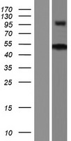 Western blot validation of overexpression lysate (Cat# LY422418) using anti-DDK antibody (Cat# TA50011-100). Left: Cell lysates from un-transfected HEK293T cells; Right: Cell lysates from HEK293T cells transfected with RC212004 using transfection reagent MegaTran 2.0 (Cat# TT210002).