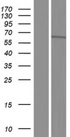 Western blot validation of overexpression lysate (Cat# LY405185) using anti-DDK antibody (Cat# TA50011-100). Left: Cell lysates from un-transfected HEK293T cells; Right: Cell lysates from HEK293T cells transfected with RC221705 using transfection reagent MegaTran 2.0 (Cat# TT210002).