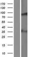 Western blot validation of overexpression lysate (Cat# LY422080) using anti-DDK antibody (Cat# TA50011-100). Left: Cell lysates from un-transfected HEK293T cells; Right: Cell lysates from HEK293T cells transfected with RC222565 using transfection reagent MegaTran 2.0 (Cat# TT210002).
