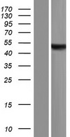 Western blot validation of overexpression lysate (Cat# LY432251) using anti-DDK antibody (Cat# TA50011-100). Left: Cell lysates from un-transfected HEK293T cells; Right: Cell lysates from HEK293T cells transfected with RC229230 using transfection reagent MegaTran 2.0 (Cat# TT210002).
