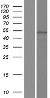 Western blot validation of overexpression lysate (Cat# LY420826) using anti-DDK antibody (Cat# TA50011-100). Left: Cell lysates from un-transfected HEK293T cells; Right: Cell lysates from HEK293T cells transfected with RC216269 using transfection reagent MegaTran 2.0 (Cat# TT210002).