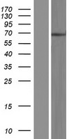 Western blot validation of overexpression lysate (Cat# LY434331) using anti-DDK antibody (Cat# TA50011-100). Left: Cell lysates from un-transfected HEK293T cells; Right: Cell lysates from HEK293T cells transfected with RC231332 using transfection reagent MegaTran 2.0 (Cat# TT210002).