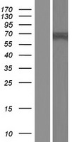 Western blot validation of overexpression lysate (Cat# LY410935) using anti-DDK antibody (Cat# TA50011-100). Left: Cell lysates from un-transfected HEK293T cells; Right: Cell lysates from HEK293T cells transfected with RC219411 using transfection reagent MegaTran 2.0 (Cat# TT210002).