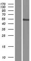 Western blot validation of overexpression lysate (Cat# LY423316) using anti-DDK antibody (Cat# TA50011-100). Left: Cell lysates from un-transfected HEK293T cells; Right: Cell lysates from HEK293T cells transfected with RC215812 using transfection reagent MegaTran 2.0 (Cat# TT210002).