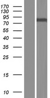 Western blot validation of overexpression lysate (Cat# LY413775) using anti-DDK antibody (Cat# TA50011-100). Left: Cell lysates from un-transfected HEK293T cells; Right: Cell lysates from HEK293T cells transfected with RC222849 using transfection reagent MegaTran 2.0 (Cat# TT210002).