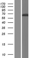 Western blot validation of overexpression lysate (Cat# LY413624) using anti-DDK antibody (Cat# TA50011-100). Left: Cell lysates from un-transfected HEK293T cells; Right: Cell lysates from HEK293T cells transfected with RC213251 using transfection reagent MegaTran 2.0 (Cat# TT210002).