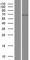Western blot validation of overexpression lysate (Cat# LY417713) using anti-DDK antibody (Cat# TA50011-100). Left: Cell lysates from un-transfected HEK293T cells; Right: Cell lysates from HEK293T cells transfected with RC220573 using transfection reagent MegaTran 2.0 (Cat# TT210002).