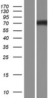 Western blot validation of overexpression lysate (Cat# LY426916) using anti-DDK antibody (Cat# TA50011-100). Left: Cell lysates from un-transfected HEK293T cells; Right: Cell lysates from HEK293T cells transfected with RC226024 using transfection reagent MegaTran 2.0 (Cat# TT210002).