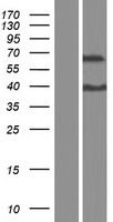 Western blot validation of overexpression lysate (Cat# LY423170) using anti-DDK antibody (Cat# TA50011-100). Left: Cell lysates from un-transfected HEK293T cells; Right: Cell lysates from HEK293T cells transfected with RC220260 using transfection reagent MegaTran 2.0 (Cat# TT210002).