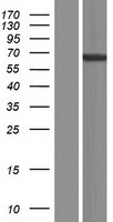Western blot validation of overexpression lysate (Cat# LY431480) using anti-DDK antibody (Cat# TA50011-100). Left: Cell lysates from un-transfected HEK293T cells; Right: Cell lysates from HEK293T cells transfected with RC228452 using transfection reagent MegaTran 2.0 (Cat# TT210002).