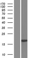 Western blot validation of overexpression lysate (Cat# LY403766) using anti-DDK antibody (Cat# TA50011-100). Left: Cell lysates from un-transfected HEK293T cells; Right: Cell lysates from HEK293T cells transfected with RC215934 using transfection reagent MegaTran 2.0 (Cat# TT210002).
