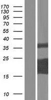 Western blot validation of overexpression lysate (Cat# LY428115) using anti-DDK antibody (Cat# TA50011-100). Left: Cell lysates from un-transfected HEK293T cells; Right: Cell lysates from HEK293T cells transfected with RC227768 using transfection reagent MegaTran 2.0 (Cat# TT210002).