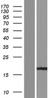 Western blot validation of overexpression lysate (Cat# LY426600) using anti-DDK antibody (Cat# TA50011-100). Left: Cell lysates from un-transfected HEK293T cells; Right: Cell lysates from HEK293T cells transfected with RC225158 using transfection reagent MegaTran 2.0 (Cat# TT210002).