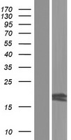 Western blot validation of overexpression lysate (Cat# LY427474) using anti-DDK antibody (Cat# TA50011-100). Left: Cell lysates from un-transfected HEK293T cells; Right: Cell lysates from HEK293T cells transfected with RC225159 using transfection reagent MegaTran 2.0 (Cat# TT210002).