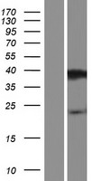 Western blot validation of overexpression lysate (Cat# LY427200) using anti-DDK antibody (Cat# TA50011-100). Left: Cell lysates from un-transfected HEK293T cells; Right: Cell lysates from HEK293T cells transfected with RC225268 using transfection reagent MegaTran 2.0 (Cat# TT210002).