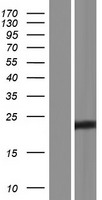 Western blot validation of overexpression lysate (Cat# LY422735) using anti-DDK antibody (Cat# TA50011-100). Left: Cell lysates from un-transfected HEK293T cells; Right: Cell lysates from HEK293T cells transfected with RC218340 using transfection reagent MegaTran 2.0 (Cat# TT210002).
