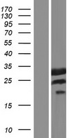 Western blot validation of overexpression lysate (Cat# LY405781) using anti-DDK antibody (Cat# TA50011-100). Left: Cell lysates from un-transfected HEK293T cells; Right: Cell lysates from HEK293T cells transfected with RC215558 using transfection reagent MegaTran 2.0 (Cat# TT210002).