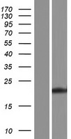 Western blot validation of overexpression lysate (Cat# LY432588) using anti-DDK antibody (Cat# TA50011-100). Left: Cell lysates from un-transfected HEK293T cells; Right: Cell lysates from HEK293T cells transfected with RC229588 using transfection reagent MegaTran 2.0 (Cat# TT210002).