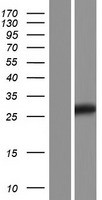 Western blot validation of overexpression lysate (Cat# LY432667) using anti-DDK antibody (Cat# TA50011-100). Left: Cell lysates from un-transfected HEK293T cells; Right: Cell lysates from HEK293T cells transfected with RC229667 using transfection reagent MegaTran 2.0 (Cat# TT210002).