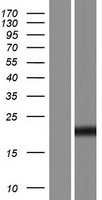 Western blot validation of overexpression lysate (Cat# LY427686) using anti-DDK antibody (Cat# TA50011-100). Left: Cell lysates from un-transfected HEK293T cells; Right: Cell lysates from HEK293T cells transfected with RC227480 using transfection reagent MegaTran 2.0 (Cat# TT210002).