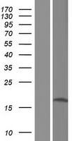 Western blot validation of overexpression lysate (Cat# LY404164) using anti-DDK antibody (Cat# TA50011-100). Left: Cell lysates from un-transfected HEK293T cells; Right: Cell lysates from HEK293T cells transfected with RC221825 using transfection reagent MegaTran 2.0 (Cat# TT210002).