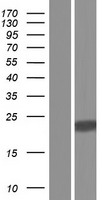 Western blot validation of overexpression lysate (Cat# LY432679) using anti-DDK antibody (Cat# TA50011-100). Left: Cell lysates from un-transfected HEK293T cells; Right: Cell lysates from HEK293T cells transfected with RC229679 using transfection reagent MegaTran 2.0 (Cat# TT210002).