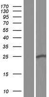 Western blot validation of overexpression lysate (Cat# LY431170) using anti-DDK antibody (Cat# TA50011-100). Left: Cell lysates from un-transfected HEK293T cells; Right: Cell lysates from HEK293T cells transfected with RC228142 using transfection reagent MegaTran 2.0 (Cat# TT210002).