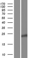 Western blot validation of overexpression lysate (Cat# LY420157) using anti-DDK antibody (Cat# TA50011-100). Left: Cell lysates from un-transfected HEK293T cells; Right: Cell lysates from HEK293T cells transfected with RC222117 using transfection reagent MegaTran 2.0 (Cat# TT210002).