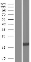 Western blot validation of overexpression lysate (Cat# LY406495) using anti-DDK antibody (Cat# TA50011-100). Left: Cell lysates from un-transfected HEK293T cells; Right: Cell lysates from HEK293T cells transfected with RC211221 using transfection reagent MegaTran 2.0 (Cat# TT210002).