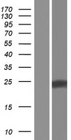 Western blot validation of overexpression lysate (Cat# LY421302) using anti-DDK antibody (Cat# TA50011-100). Left: Cell lysates from un-transfected HEK293T cells; Right: Cell lysates from HEK293T cells transfected with RC224125 using transfection reagent MegaTran 2.0 (Cat# TT210002).