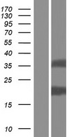 Western blot validation of overexpression lysate (Cat# LY432609) using anti-DDK antibody (Cat# TA50011-100). Left: Cell lysates from un-transfected HEK293T cells; Right: Cell lysates from HEK293T cells transfected with RC229609 using transfection reagent MegaTran 2.0 (Cat# TT210002).