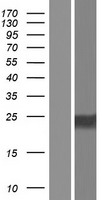 Western blot validation of overexpression lysate (Cat# LY426759) using anti-DDK antibody (Cat# TA50011-100). Left: Cell lysates from un-transfected HEK293T cells; Right: Cell lysates from HEK293T cells transfected with RC225231 using transfection reagent MegaTran 2.0 (Cat# TT210002).