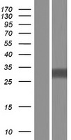 Western blot validation of overexpression lysate (Cat# LY432619) using anti-DDK antibody (Cat# TA50011-100). Left: Cell lysates from un-transfected HEK293T cells; Right: Cell lysates from HEK293T cells transfected with RC229619 using transfection reagent MegaTran 2.0 (Cat# TT210002).