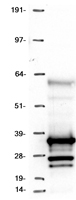 Western blot validation of overexpression lysate (Cat# LY428261) using anti-DDK antibody (Cat# TA50011-100). Left: Cell lysates from un-transfected HEK293T cells; Right: Cell lysates from HEK293T cells transfected with RC227425 using transfection reagent MegaTran 2.0 (Cat# TT210002).