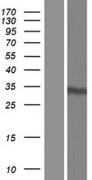 Western blot validation of overexpression lysate (Cat# LY414140) using anti-DDK antibody (Cat# TA50011-100). Left: Cell lysates from un-transfected HEK293T cells; Right: Cell lysates from HEK293T cells transfected with RC209354 using transfection reagent MegaTran 2.0 (Cat# TT210002).