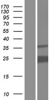 Western blot validation of overexpression lysate (Cat# LY412532) using anti-DDK antibody (Cat# TA50011-100). Left: Cell lysates from un-transfected HEK293T cells; Right: Cell lysates from HEK293T cells transfected with RC202526 using transfection reagent MegaTran 2.0 (Cat# TT210002).