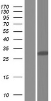 Western blot validation of overexpression lysate (Cat# LY409310) using anti-DDK antibody (Cat# TA50011-100). Left: Cell lysates from un-transfected HEK293T cells; Right: Cell lysates from HEK293T cells transfected with RC224954 using transfection reagent MegaTran 2.0 (Cat# TT210002).