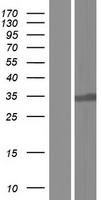 Western blot validation of overexpression lysate (Cat# LY434095) using anti-DDK antibody (Cat# TA50011-100). Left: Cell lysates from un-transfected HEK293T cells; Right: Cell lysates from HEK293T cells transfected with RC231096 using transfection reagent MegaTran 2.0 (Cat# TT210002).