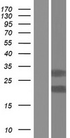Western blot validation of overexpression lysate (Cat# LY428471) using anti-DDK antibody (Cat# TA50011-100). Left: Cell lysates from un-transfected HEK293T cells; Right: Cell lysates from HEK293T cells transfected with RC227028 using transfection reagent MegaTran 2.0 (Cat# TT210002).