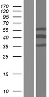 Western blot validation of overexpression lysate (Cat# LY421601) using anti-DDK antibody (Cat# TA50011-100). Left: Cell lysates from un-transfected HEK293T cells; Right: Cell lysates from HEK293T cells transfected with RC217184 using transfection reagent MegaTran 2.0 (Cat# TT210002).