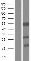 Western blot validation of overexpression lysate (Cat# LY432746) using anti-DDK antibody (Cat# TA50011-100). Left: Cell lysates from un-transfected HEK293T cells; Right: Cell lysates from HEK293T cells transfected with RC229746 using transfection reagent MegaTran 2.0 (Cat# TT210002).