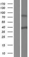 Western blot validation of overexpression lysate (Cat# LY432190) using anti-DDK antibody (Cat# TA50011-100). Left: Cell lysates from un-transfected HEK293T cells; Right: Cell lysates from HEK293T cells transfected with RC229166 using transfection reagent MegaTran 2.0 (Cat# TT210002).