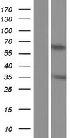 Western blot validation of overexpression lysate (Cat# LY421593) using anti-DDK antibody (Cat# TA50011-100). Left: Cell lysates from un-transfected HEK293T cells; Right: Cell lysates from HEK293T cells transfected with RC222313 using transfection reagent MegaTran 2.0 (Cat# TT210002).