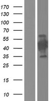 Western blot validation of overexpression lysate (Cat# LY421594) using anti-DDK antibody (Cat# TA50011-100). Left: Cell lysates from un-transfected HEK293T cells; Right: Cell lysates from HEK293T cells transfected with RC214587 using transfection reagent MegaTran 2.0 (Cat# TT210002).