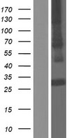 Western blot validation of overexpression lysate (Cat# LY432756) using anti-DDK antibody (Cat# TA50011-100). Left: Cell lysates from un-transfected HEK293T cells; Right: Cell lysates from HEK293T cells transfected with RC229756 using transfection reagent MegaTran 2.0 (Cat# TT210002).