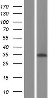 Western blot validation of overexpression lysate (Cat# LY413666) using anti-DDK antibody (Cat# TA50011-100). Left: Cell lysates from un-transfected HEK293T cells; Right: Cell lysates from HEK293T cells transfected with RC202849 using transfection reagent MegaTran 2.0 (Cat# TT210002).
