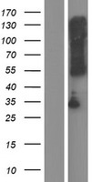 Western blot validation of overexpression lysate (Cat# LY426613) using anti-DDK antibody (Cat# TA50011-100). Left: Cell lysates from un-transfected HEK293T cells; Right: Cell lysates from HEK293T cells transfected with RC225376 using transfection reagent MegaTran 2.0 (Cat# TT210002).