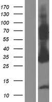 Western blot validation of overexpression lysate (Cat# LY432774) using anti-DDK antibody (Cat# TA50011-100). Left: Cell lysates from un-transfected HEK293T cells; Right: Cell lysates from HEK293T cells transfected with RC229774 using transfection reagent MegaTran 2.0 (Cat# TT210002).