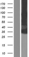 Western blot validation of overexpression lysate (Cat# LY427554) using anti-DDK antibody (Cat# TA50011-100). Left: Cell lysates from un-transfected HEK293T cells; Right: Cell lysates from HEK293T cells transfected with RC225354 using transfection reagent MegaTran 2.0 (Cat# TT210002).
